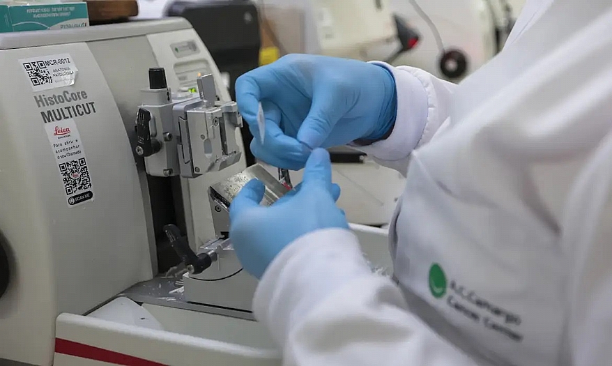 Câncer de próstata: atendimento aumenta 32% em homens com até 49 anos