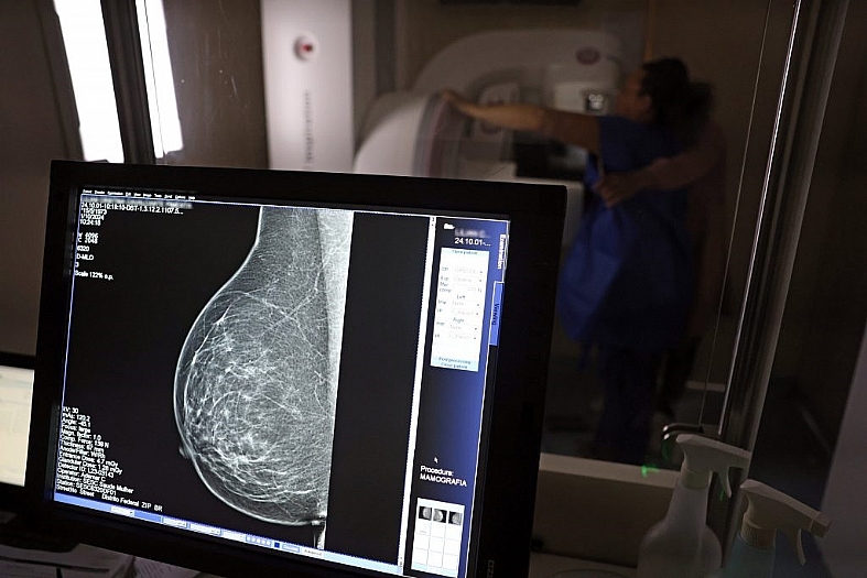 Baixa adesão à mamografia dificulta diagnóstico de câncer de mama veja hábitos que reduzem fatores de risco