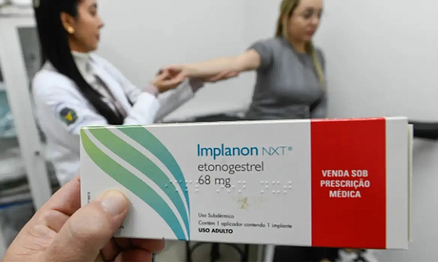 Implante contraceptivo deve ser ofertado por planos de saúde